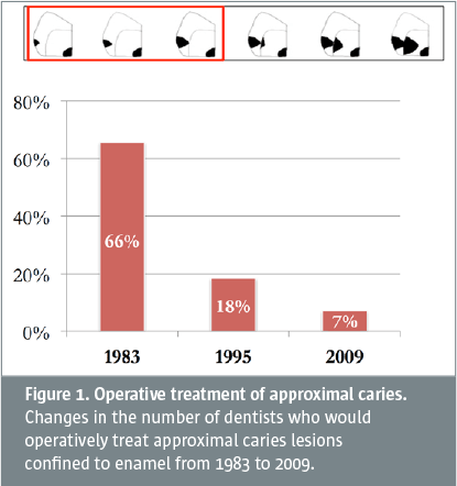 Minimal intervention dentistry – all caries lesions do not need operative treatment