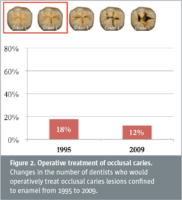 Minimal intervention dentistry – all caries lesions do not need operative treatment