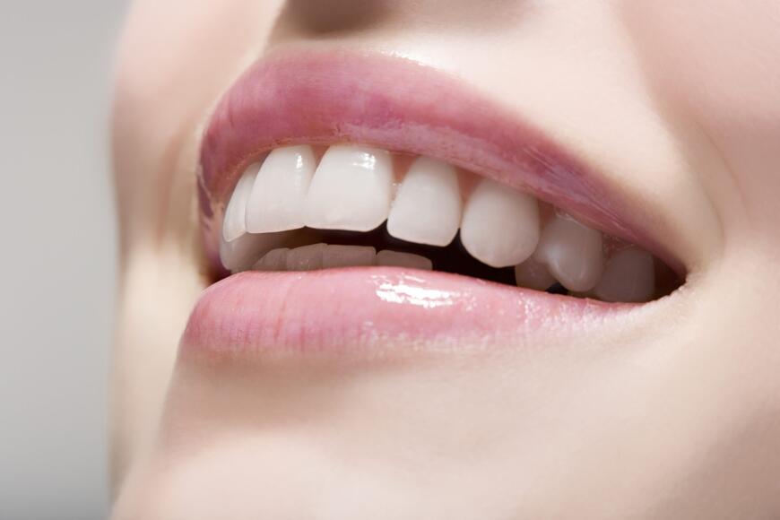 Resin-based cements – properties affecting clinical success of indirect restorations
