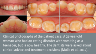 Restorative treatment of erosive lesions among Norwegian dentists