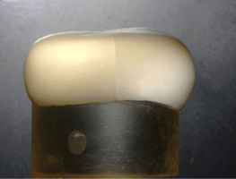 Simulating clinical fractures of all-ceramic crowns