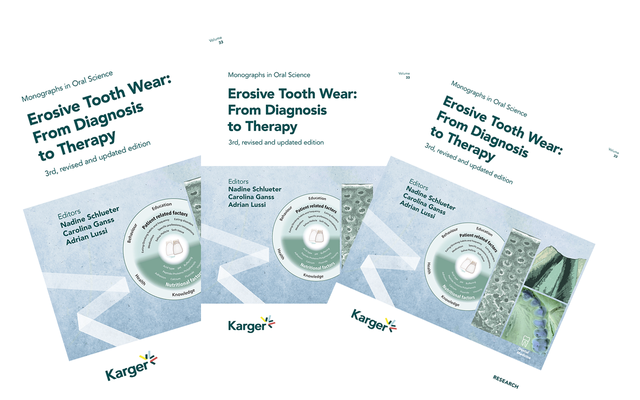 Illustration of book cover: Erosive Tooth Wear