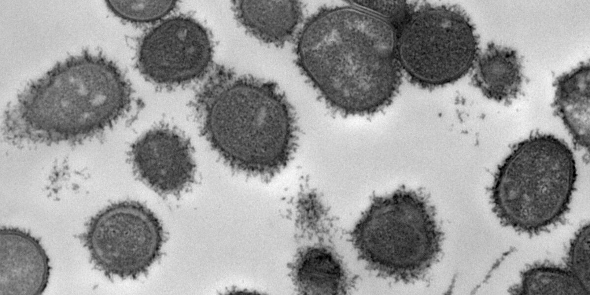 https://www.niom.no/former-visiting-scientist-publishes-new-research-using-niom-methodology.6726976-606094.html