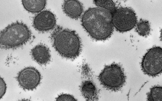 https://www.niom.no/former-visiting-scientist-publishes-new-research-using-niom-methodology.6726976-606094.html